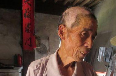 武汉北大白癜风医院介绍诱发老年白癜风的病因是什么?